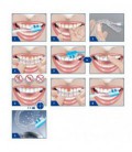 MEILLEURS Teeth Kit de blanchiment avec système LED Light Blue, 3 Gel Seringues, 2 plateaux, Professional 44% de peroxyde d'hydr